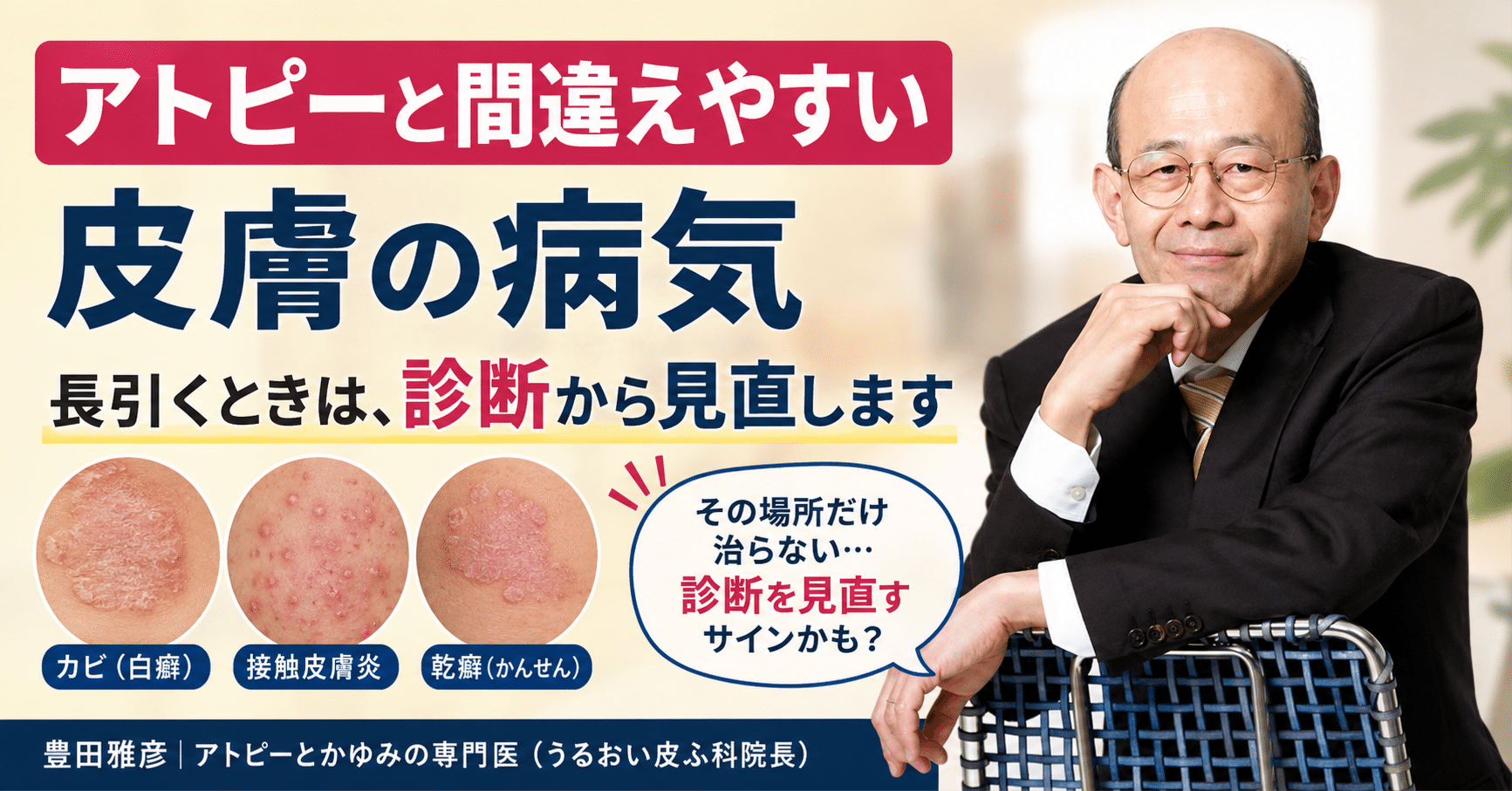 アトピーと間違えやすい皮膚の病気